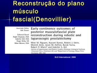 Reconstrução do plano músculo fascial( Denovillier ) BJU  International ,  2008   