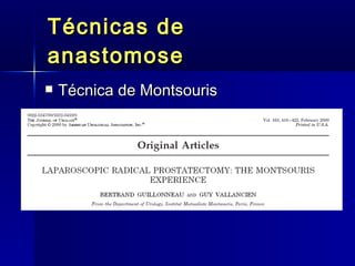 Técnicas de anastomose Técnica de Montsouris 