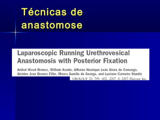 Técnicas de anastomose 