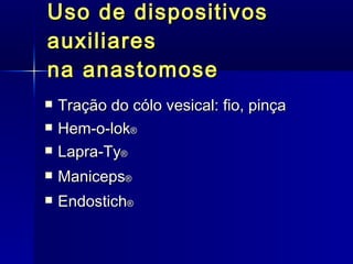 Uso de dispositivos auxiliares na anastomose Tração do cólo vesical: fio, pinça  Hem-o-lok ®  Lapra-Ty ® Maniceps ®   Endostich ®   
