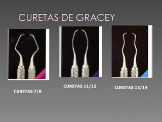 CURETAS 7/8 CURETAS 11/12 CURETAS 13/14 