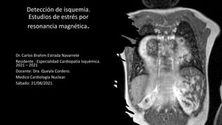 Detección de isquemia.
Estudios de estrés por
resonancia magnética.
Dr. Carlos Brahim Estrada Navarrete
Residente : Especialidad Cardiopatía Isquémica.
2021 – 2021
Docente: Dra. Queyla Cordero.
Medico Cardiología Nuclear.
Sábado: 21/08/2021.
 