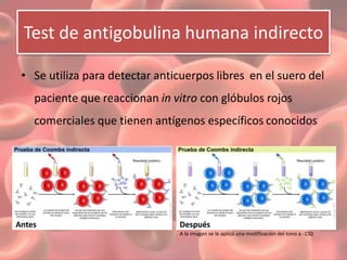 Test de antigobulina humana indirecto 
• Se utiliza para detectar anticuerpos libres en el suero del 
paciente que reaccionan in vitro con glóbulos rojos 
comerciales que tienen antígenos específicos conocidos 
Antes Después 
A la imagen se le aplicó una modificación del tono a -150 
 