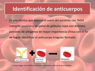 Identificación de anticuerpos 
• Es una técnica que expone el suero del paciente con TAGH 
indirecto positivo a un panel de glóbulos rojos con distintos 
patrones de antígenos de mayor importancia clínica con el fin 
de lograr identificar el anticuerpo irregular formado 
Panel de GR 
comerciales 
Antes 
Suero del paciente 
Después 
A esta imagen se le modifico el tamaño y la rotación, además de que se triplico 
 