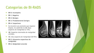 Detección temprana de cancer de mama.pptx
