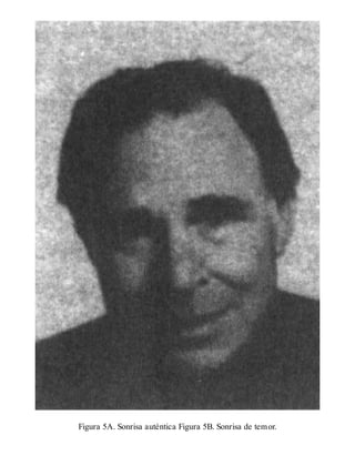 Figura 5A. Sonrisa auténtica Figura 5B. Sonrisa de temor.
 