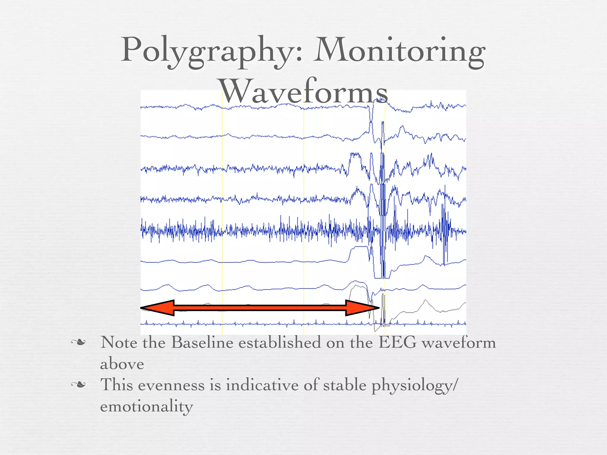 Polygraphy: Monitoring
            Waveforms




   Note the Baseline established on the EEG waveform
    above
   This evenness is indicative of stable physiology/
    emotionality
 