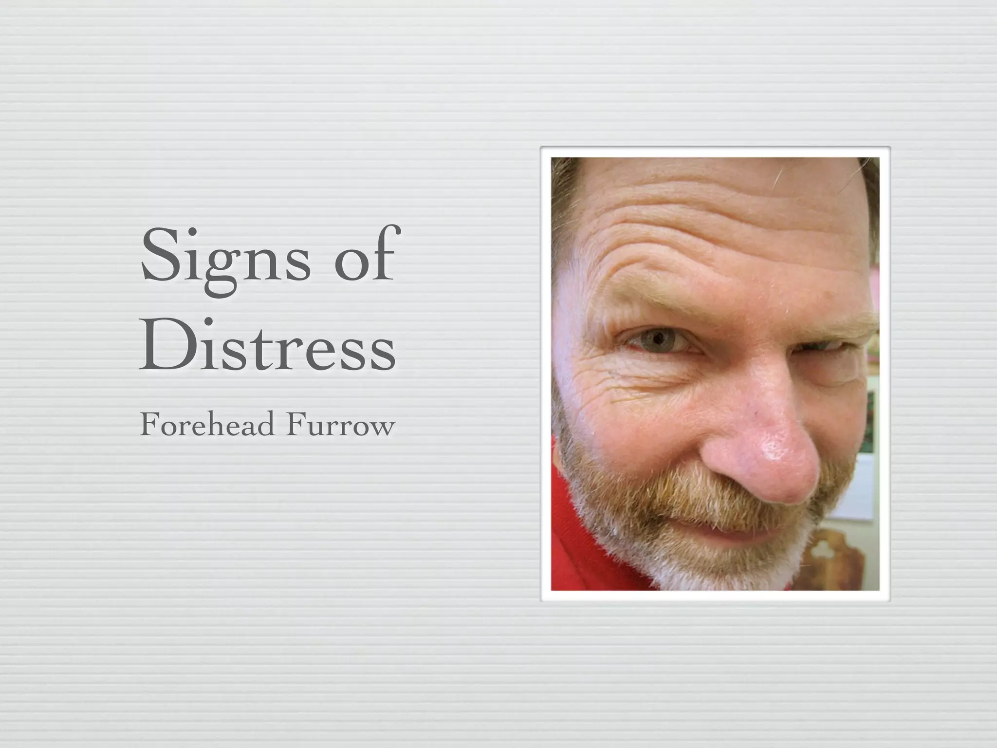 Signs of
Distress
Forehead Furrow
 