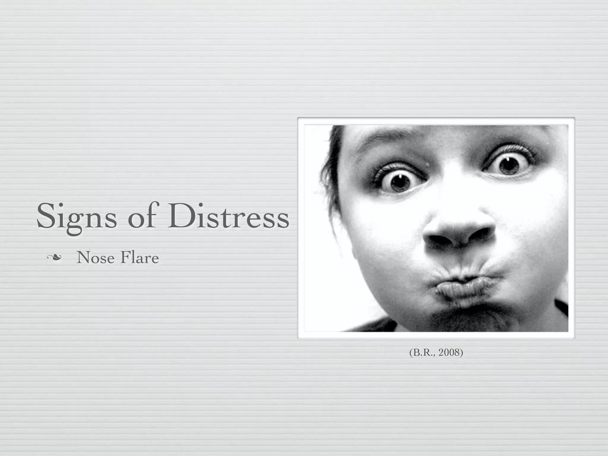 Signs of Distress
   Nose Flare




                    (B.R., 2008)
 