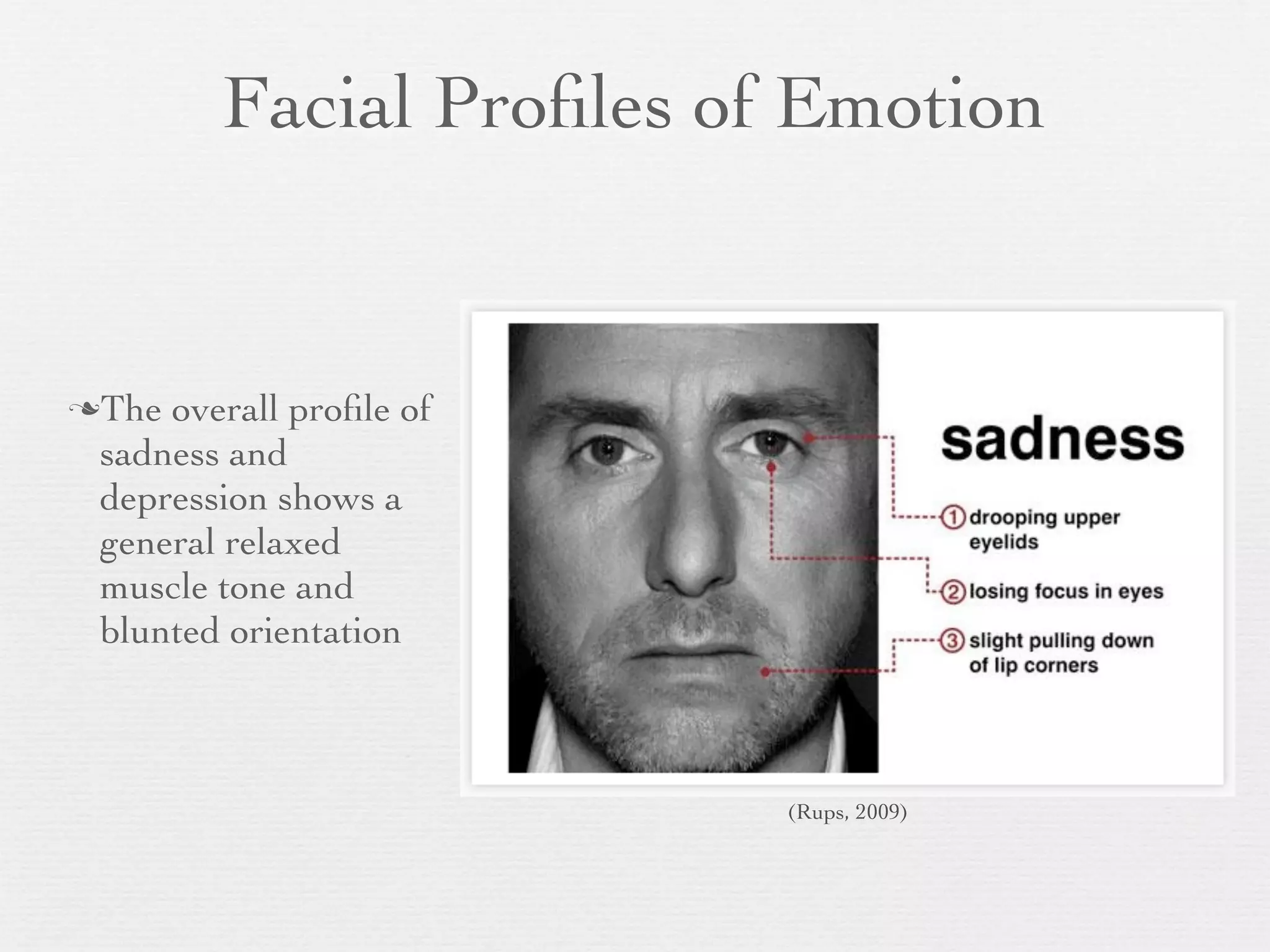 Facial Proﬁles of Emotion


The overall proﬁle of
 sadness and
 depression shows a
 general relaxed
 muscle tone and
 blunted orientation



                         (Rups, 2009)
 