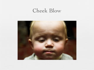 Cheek Blow
 