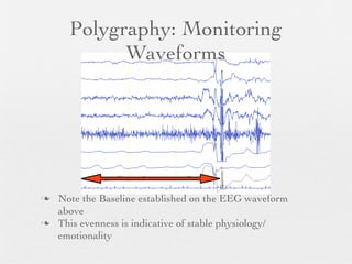 Polygraphy: Monitoring
            Waveforms




   Note the Baseline established on the EEG waveform
    above
   This evenness is indicative of stable physiology/
    emotionality
 