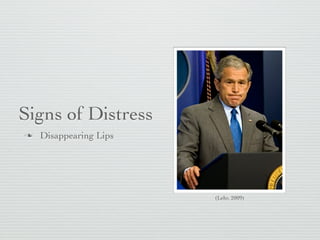 Signs of Distress
   Disappearing Lips




                        (Lehr, 2009)
 