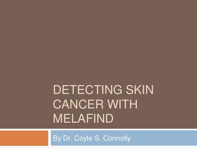 detecting skin cancer with melafind dr coyle s connolly dr coyle connolly