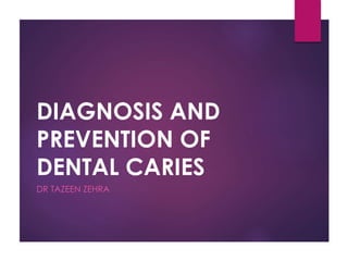 DIAGNOSIS AND
PREVENTION OF
DENTAL CARIES
DR TAZEEN ZEHRA
 