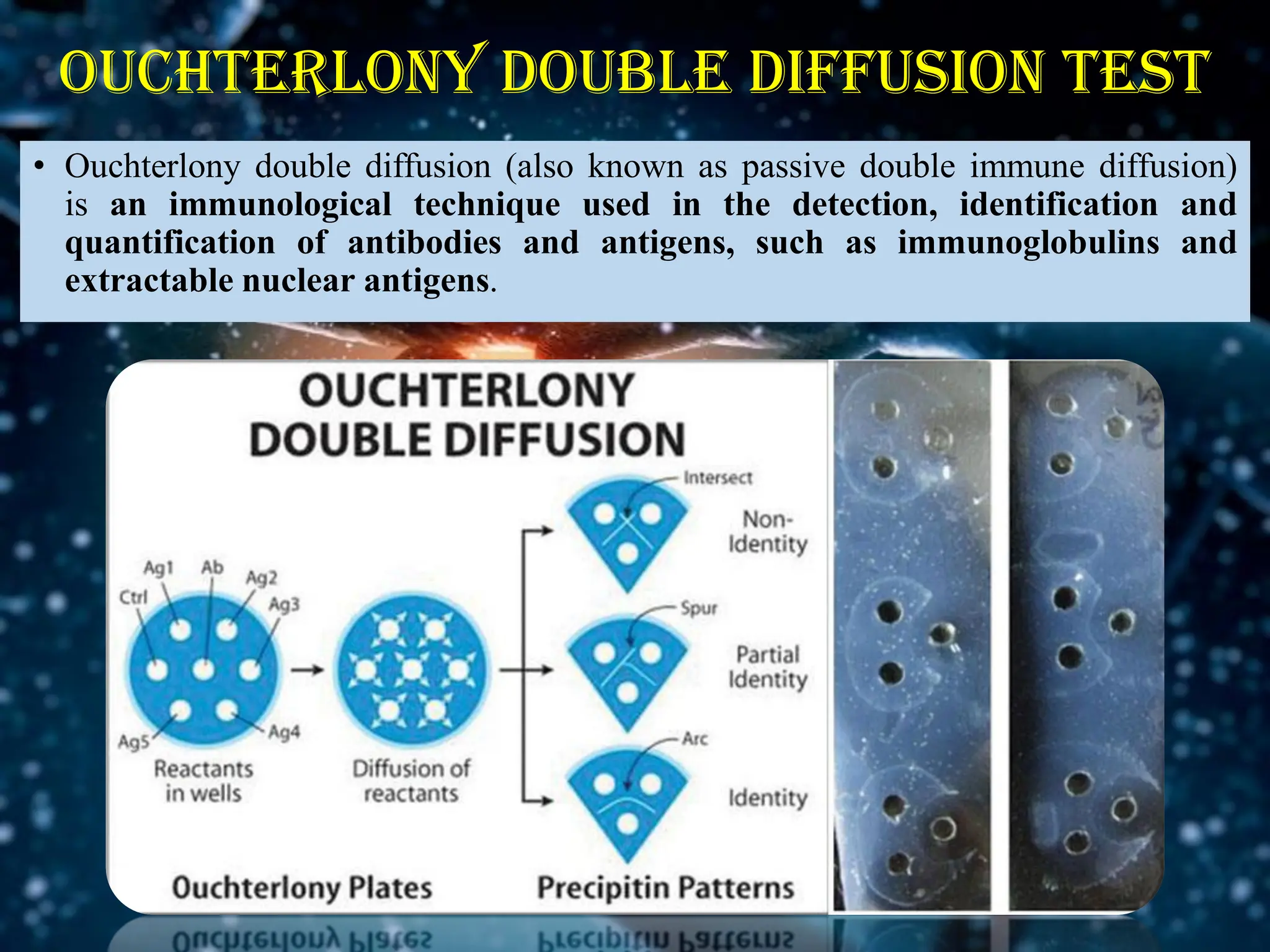 Ouchterlony double diffusion test
• Ouchterlony double diffusion (also known as passive double immune diffusion)
is an immunological technique used in the detection, identification and
quantification of antibodies and antigens, such as immunoglobulins and
extractable nuclear antigens.
 