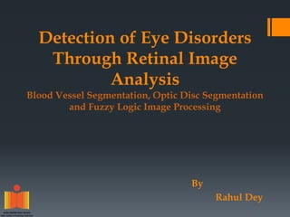 Detection of Eye Disorders
Through Retinal Image
Analysis
Blood Vessel Segmentation, Optic Disc Segmentation
and Fuzzy Logic Image Processing
By
Rahul Dey
 