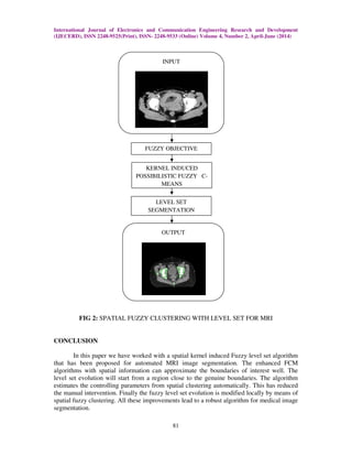 International Journal of Electronics and Communication Engineering Research and Development
(IJECERD), ISSN 2248-9525(Print), ISSN- 2248-9533 (Online) Volume 4, Number 2, April-June (2014)
81
FIG 2: SPATIAL FUZZY CLUSTERING WITH LEVEL SET FOR MRI
CONCLUSION
In this paper we have worked with a spatial kernel induced Fuzzy level set algorithm
that has been proposed for automated MRI image segmentation. The enhanced FCM
algorithms with spatial information can approximate the boundaries of interest well. The
level set evolution will start from a region close to the genuine boundaries. The algorithm
estimates the controlling parameters from spatial clustering automatically. This has reduced
the manual intervention. Finally the fuzzy level set evolution is modified locally by means of
spatial fuzzy clustering. All these improvements lead to a robust algorithm for medical image
segmentation.
INPUT
KERNEL INDUCED
POSSIBILISTIC FUZZY C-
MEANS
FUZZY OBJECTIVE
LEVEL SET
SEGMENTATION
OUTPUT
 
