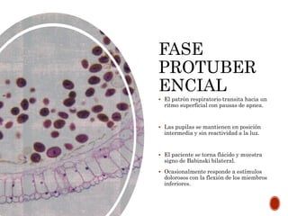FASE
PROTUBER
ENCIAL
 El patrón respiratorio transita hacia un
ritmo superficial con pausas de apnea.
 Las pupilas se mantienen en posición
intermedia y sin reactividad a la luz.
 El paciente se torna flácido y muestra
signo de Babinski bilateral.
 Ocasionalmente responde a estímulos
dolorosos con la flexión de los miembros
inferiores.
 