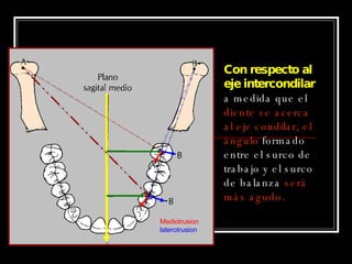 Mediotrusion laterotrusion Con respecto al eje intercondilar  a medida que el  diente se acerca al eje condilar, el ángulo  formado entre el surco de trabajo y el surco de balanza  será más agudo. 