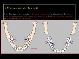 3.  Movimiento de Bennett A medida que el movimiento de  Bennett se aumenta , la dirección de los  surcos  tanto de trabajo como de balanza será más hacia distal en el maxilar superior . En la mandíbula es a la inversa. Mediotrusion laterotrusion 
