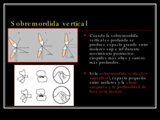 Cuando la sobremordida vertical es profunda se produce espacio grande entre molares sup e inf durante movimiento protrusivo: cúspides más altas y surcos más profundos. Si la  sobremordida vertical es superficial , espacio pequeño entre molares y la  altura cuspídea y la profundidad de fosa será menor. Sobremordida vertical 