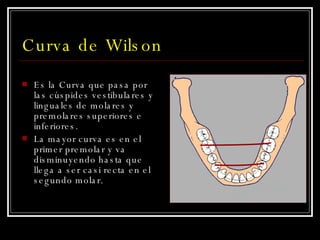 Curva de Wilson Es la Curva que pasa por las cúspides vestibulares y linguales de molares y premolares superiores e inferiores.  La mayor curva es en el primer premolar y va disminuyendo hasta que llega a ser casi recta en el segundo molar. 
