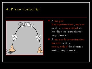 4. Plano horizontal A  mayor lateroprotrusion ,  mayor  será la  concavidad  de los dientes anteriores superiores.  A  mayor lateroretrusion   menor  será la  concavidad  de dientes anterosuperiores. 