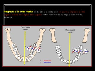 Respecto a la línea media : El diente a medida que  se acerca al plano medio sagital, tendrá un ángulo más agudo  entre el surco de trabajo y el surco de  Balanza. Mediotrusion laterotrusion 