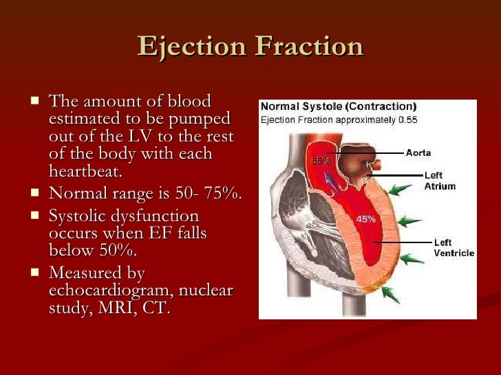 Determinants of cardiac output for captivate