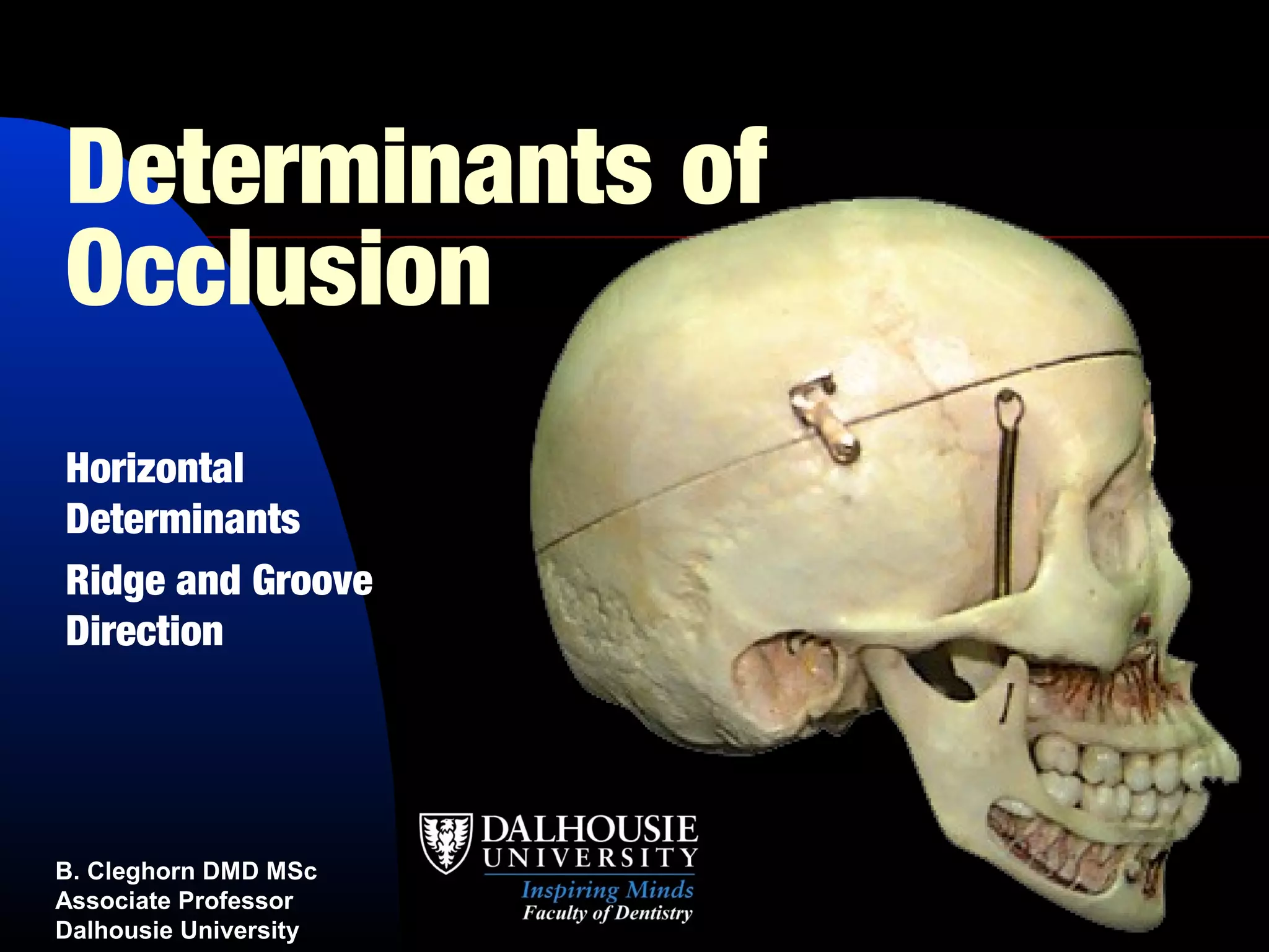 Determinants of
Occlusion
Horizontal
Determinants
Ridge and Groove
Direction




B. Cleghorn DMD MSc
Associate Professor
Dalhousie University
 