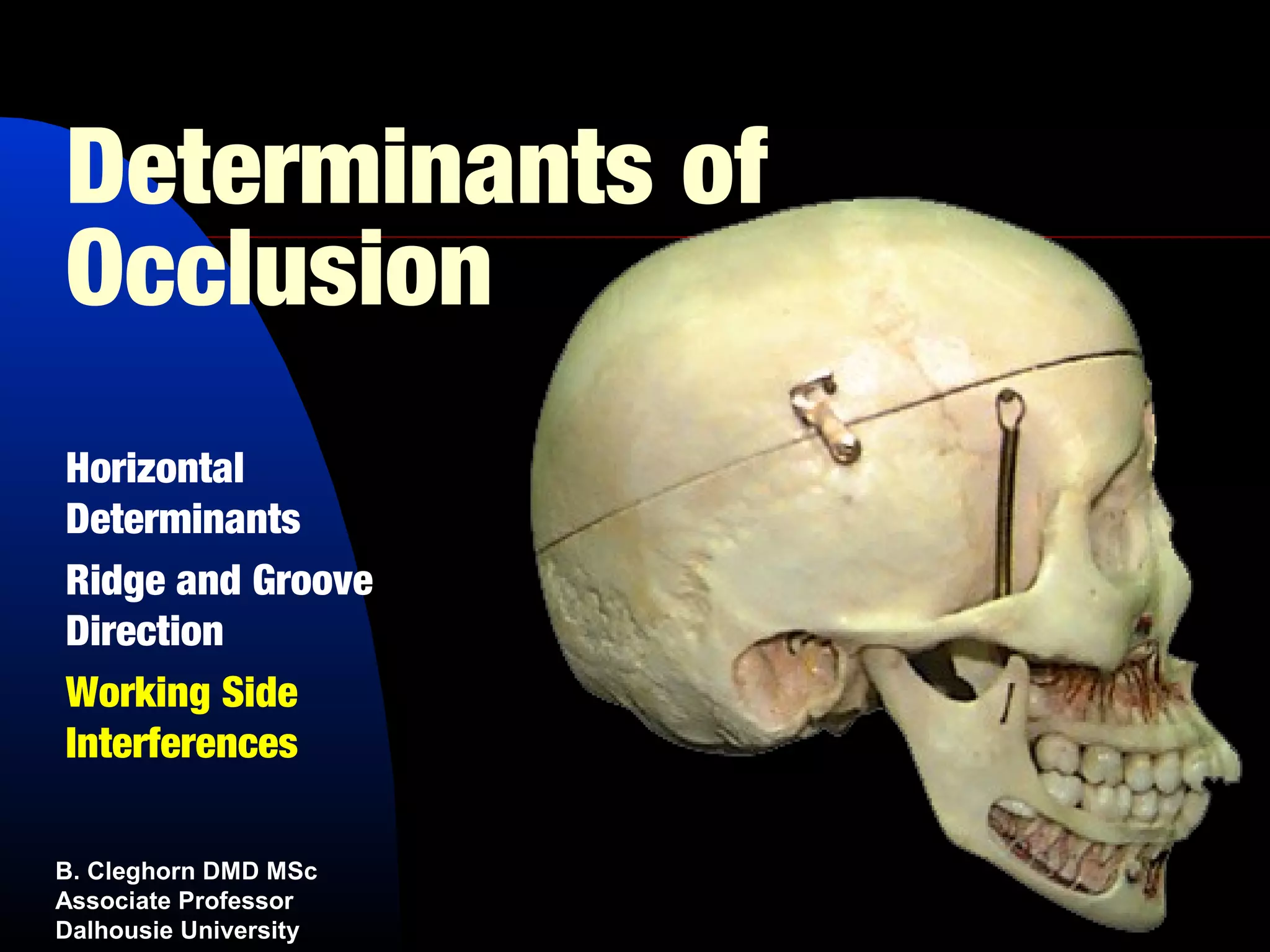 Determinants of
Occlusion
Horizontal
Determinants
Ridge and Groove
Direction
Working Side
Interferences

B. Cleghorn DMD MSc
Associate Professor
Dalhousie University
 