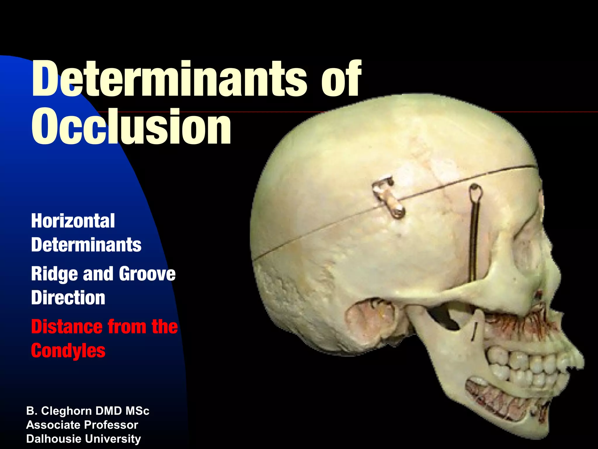 Determinants of
Occlusion
Horizontal
Determinants
Ridge and Groove
Direction
Distance from the
Condyles

B. Cleghorn DMD MSc
Associate Professor
Dalhousie University
 