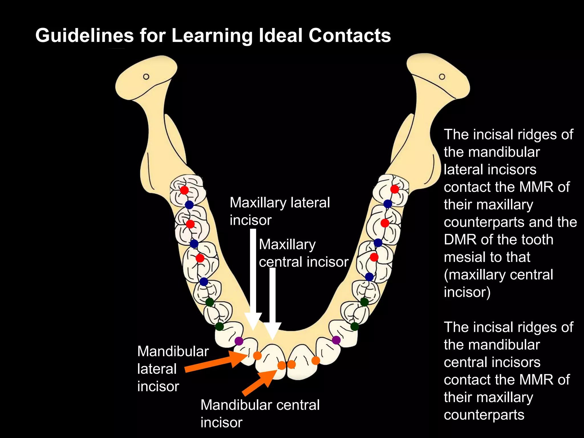 Guidelines for Learning Ideal Contacts




                                             The incisal ridges of
                                             the mandibular
                                             lateral incisors
                                             contact the MMR of
                       Maxillary lateral     their maxillary
                       incisor               counterparts and the
                           Maxillary         DMR of the tooth
                           central incisor   mesial to that
                                             (maxillary central
                                             incisor)

                                             The incisal ridges of
          Mandibular                         the mandibular
          lateral                            central incisors
          incisor                            contact the MMR of
                                             their maxillary
                   Mandibular central
                                             counterparts
                   incisor
 