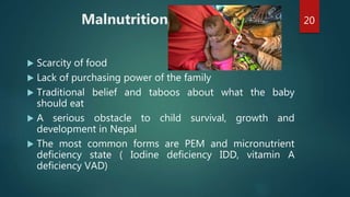 Determinants of under five children morbidity and mortality | PPTX
