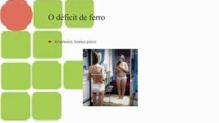 O déficit de ferro
 Anorexia, baixo peso
 