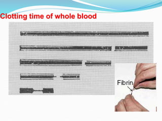DETERMINATION OF BLEEDING AND CLOTTING TIME Ass.Lec Hussein Hamid Al ...