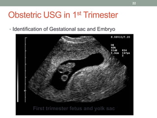 Gs Measure Determination of gestational age revised copy | PPTX