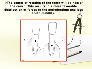 The center of rotation of the tooth will be nearer the crown. This results in a more favorable distribution of forces to the periodontium and less tooth mobility. 
