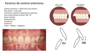 Determinantes oclusion morfologia dental | PPTX
