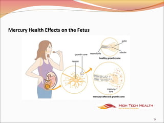 Mercury Health Effects on the Fetus
71
 