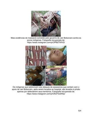 524
Mais evidências do massacre cometido pelo governo de Jair Bolsonaro contra os
povos indígenas. Fotografia recuperada de:
https://www.instagram.com/p/CfPBZTfrfVG/
Os indígenas que sobrevivem aos ataques de assassinos que contam com o
apoio de Jair Bolsonaro, após serem levados ao hospital, são levados à prisão
apenas por defenderem seus territórios. Fotografia recuperada de:
https://www.instagram.com/p/CfSvFGotH0p/
 