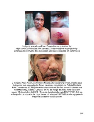 539
Indígena atacado no Peru. Fotografias recuperadas de:
https://www.diariovoces.com.pe/186333/lider-indigena-es-golpeado-y-
amenazado-de-muerte-tras-denunciar-actividades-ilegales-en-su-territorio
O indígena Allan Adam, da Primeira Nação Athabasca Chipeywan, mostra seus
ferimentos que, segundo ele, foram causados por oficiais da Polícia Montada
Real Canadense (RCMP) do destacamento Wood Buffalo em um incidente em
Fort McMurray, Alberta, Canadá, em 10 de março de 2020. Foto tirada em
março 10 de outubro de 2020. (Cortesia de Allan Adam via REUTERS.). Extrato
e fotografia recuperada de: https://www.rcinet.ca/es/2020/06/09/quien-golpeo-al-
indigena-canadiense-allan-adam/
 