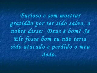 Furioso e sem mostrar
gratidão por ter sido salvo, o
nobre disse:  Deus é bom? Se
 Ele fosse bom eu não teria
sido atacado e perdido o meu
            dedo.
 