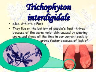 Trichophyton interdigidale a.k.a. Athlete's Foot They live on the bottom of people's feet thrives because of the warm moist skin caused by wearing socks and shoes all the time in our current society This type of fungi grows faster because of lack of ventilation to the feet.  
