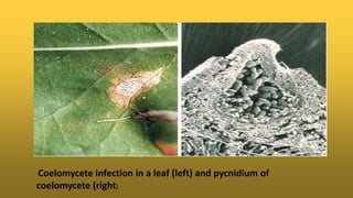 Coelomycete infection in a leaf (left) and pycnidium of
coelomycete (right)
 