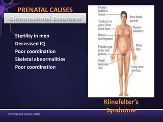 (Pierangelo & Giuliani, 2007)
Sterility in men
Decreased IQ
Poor coordination
Skeletal abnormalities
Poor coordination
PRENATAL CAUSES
Klinefelter’s
Syndrome
 