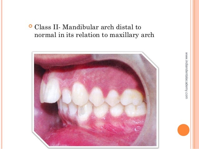 developmental disturbances of jaws dental arch oral surgery cours dental arch