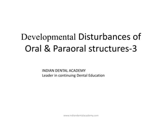 Developmental Disturbances of
Oral & Paraoral structures-3
INDIAN DENTAL ACADEMY
Leader in continuing Dental Education
www.indiandentalacademy.com
 