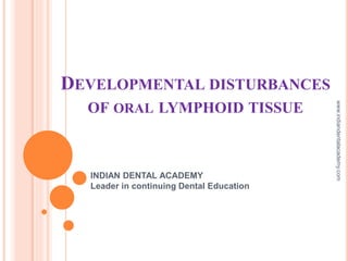 DEVELOPMENTAL DISTURBANCES
OF ORAL LYMPHOID TISSUE
INDIAN DENTAL ACADEMY
Leader in continuing Dental Education
www.indiandentalacademy.com
 